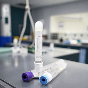 Лидер продаж, 10 мл PRF трубка для сбора крови высокой концентрации Acd гель вакуумная трубка для клинических испытаний - Product Image 5