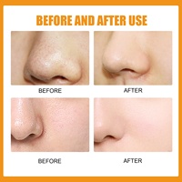 Patch Nasal Hydrocolloïde Beige EELHOE Transfrontalier au Thé Vert, Doux, Rafraîchissant, Nettoyant, Équilibrant, Hydratant et Délicat