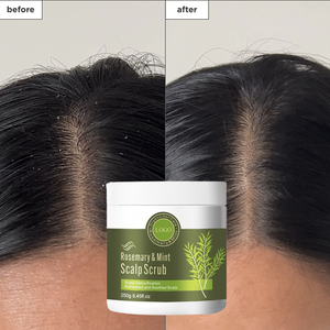 <span class=keywords><strong>Shampoo</strong></span> Antiforfora 2-in-1 con Etichetta Privata, Trattamento per la Cura del Cuoio Capelluto, Scrub Esfoliante Detox al Rosmarino e Menta Piperita - Product Image 2