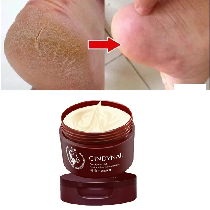 Crème pour les pieds réparatrice anti-fongique Crème pour les pieds réparatrice pour la peau morte exfoliante hydratante pour les talons crevassés