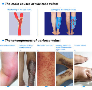 <span class=keywords><strong>Medias</strong></span> de venas varicosas de nivel moderado de talla grande 15-20 Mmhg <span class=keywords><strong>para</strong></span> mujer con alta compresión - Product Image 6