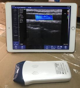 Color Doppler 7,5 Mhz 10Mhz 128 elementos WiFi escáner de ultrasonido inalámbrico sonda lineal PW <span class=keywords><strong>software</strong></span> de ultrasonido - Product Image 6