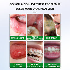 Spray pour soulager la gorge et la bouche sèches, hydrate et rafraîchit pour soulager rapidement l'inconfort causé par la climatisation ou la parole - Product Image 3
