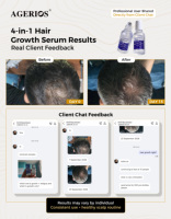 Sérum capillaire Capixyl Redensyl cliniquement prouvé, traitement de repousse rapide des cheveux, 12 semaines, essence anti-chute de cheveux, OEM