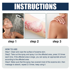 Spray Herbal South Moon para Aliviar la Picazón, la Desquamation y el <span class=keywords><strong>Eczema</strong></span> del Cuero Cabelludo, <span class=keywords><strong>Tratamiento</strong></span> para la Tinea, Aplicación Corporal - Product Image 4