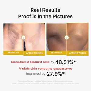 medicube Body Peel Shot con Cúrcuma, Suero Exfoliante Corporal Suave con BHA, LHA y <span class=keywords><strong>PHA</strong></span> para Células Muertas de la Piel y Sebo - Product Image 5