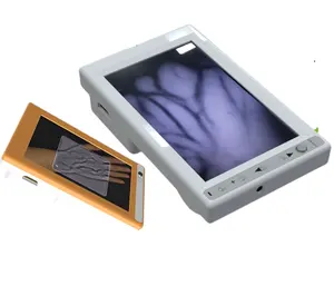 MC401最も費用対効果の高い価格LCDディスプレイポータブル静脈ファインダービューアーコンピューター画面で動作