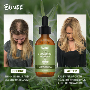 Meilleure marque privée, huile à base de plantes pour repousse rapide, traitement anti-chute du cuir chevelu pour hommes et femmes, cheveux toniques