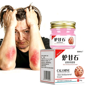 Crème topique antiprurigineuse et antibactérienne à la calamine, vente en gros d'usine, pour usage corporel, contre la chaleur irritante, les piqûres de moustiques, pour tous types de peau - Product Image 1
