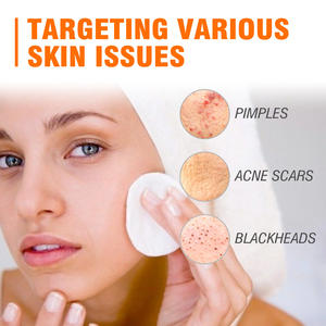 เจลบำรุงผิวกรดซาลิไซลิกให้ความชุ่มชื้นคืนความอ่อนเยาว์ให้ผิวลดรอยแผลเป็นนวดป้องกันสิว - Product Image 5