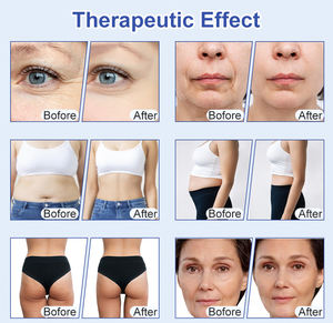 Máquina Nova 11 en 1 para Adelgazamiento Corporal, Cuidado de la Piel Facial, Levantamiento de Glúteos y Pérdida de Peso con Rodillo de Vacío 80K - Product Image 6