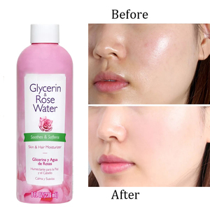 Tónico <span class=keywords><strong>Facial</strong></span> Orgánico OEM ODM, Hidratante, Calmante, Nutritivo, con Glicerina y Agua de Rosas - Product Image 2