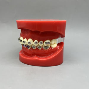 โมเดลฟันเรซินพร้อมลวดจัดฟันและลวดสลิงสำหรับอุปกรณ์ทันตกรรมแหล่งพลังงานด้วยตนเอง - Product Image 3