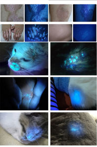 Hot Sale Haushalts medizin für Vitiligo Psoriasis Behandlung Psoriasis Behandlung Vitiligo Behandlung Heilung Handheld - Product Image 2