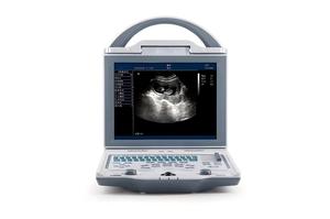 Escáner de Ultrasonido Veterinario Portátil KX5600V con Pantalla LED de 10.4 Pulgadas y Sonda Microconvexa de 6.5MHz para Animales Pequeños - Product Image 2