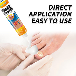 Crème antifongique à base de plantes pour les ongles 20g – Traitement pour l'onychomycose et réparation des infections fongiques endommagées - Product Image 2