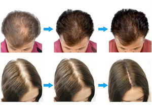 Máquina de Terapia de Luz Roja Bio Corriente Vertical 7 en 1 para el Crecimiento del Cabello y Cuidado Facial con Vibraciones y Masaje - Product Image 4