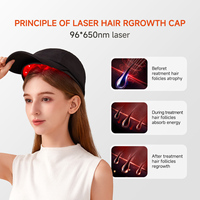 Casque de thérapie infrarouge personnalisé 96*650nm NIR LED pour la croissance des cheveux et le traitement laser contre la perte de cheveux