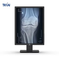 21,3 Zoll 3MP Medizinischer LCD-Monitor IPS-Panel LED-Bildschirm DP-Anschluss für Desktop-Medizingeräte
