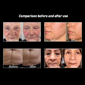 Mesin kecantikan wajah terfokus portabel, mesin profesional Anti Keriput penghilang lemak ramping badan 11d Hifu 2 pegangan - Product Image 5