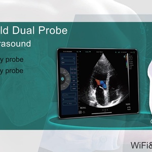 Professional <b>WiFi</b>&<b>USB</b> Phased Array Vet Ultrasonic Probe Scanner for Cardiac Blood Vessel Handheld Dual Probe Ultrasound CU100 - Product Image 2