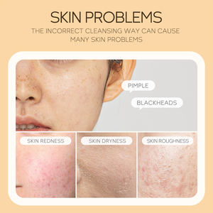 LAIKOU 120ml Mousse Nettoyante Visage Anti-Âge à la Vitamine C et Niacinamide, Lotion Huileuse, Marque Privée, Vente en Gros, Nettoyant Facial - Product Image 4