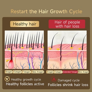 Champú Natural Orgánico de Marca Privada Contra la Caída del Cabello, Set de Aceites Esenciales para el Tratamiento del Cuero Cabelludo, para el <span class=keywords><strong>Crecimiento</strong></span> del Cabello, Reparación del Cabello Dañado - Product Image 4