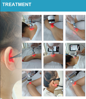 Appareil de physiothérapie au laser à diode de classe 4 Sunrise avec longueurs d'onde de 980 nm et 1064 nm, puissance de 30 W et 40 W, HILT Fisioterapia