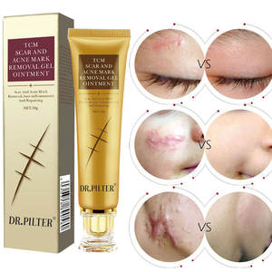 Le gel <span class=keywords><strong>pour</strong></span> cicatrices en <span class=keywords><strong>silicone</strong></span> de qualité médicale de marque privée convient à toutes les cicatrices cutanées et au gel d'élimination de l'acné <span class=keywords><strong>pour</strong></span> la réparation de la peau - Product Image 6