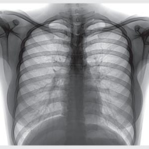 Impresora Portátil de Película Seca para Radiografía Médica, Procesador de Película Termográfica Digital, Serie HQ-DY - Product Image 5