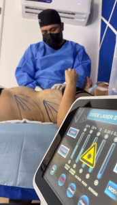 Machine de raffermissement cutané à fibre optique, laser BBL diode 980nm 1470nm pour liposuccion, <span class=keywords><strong>injection</strong></span> de graisse, raffermissement facial et <span class=keywords><strong>lipolyse</strong></span> - Product Image 4