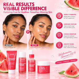 Kit de Soins Visage Éclaircissant Anti-Âge Hydratant à la Vitamine C et à la Pastèque (Marque Blanche) – Sérum, Crème et Nettoyant pour une Peau Éclatante - Product Image 2