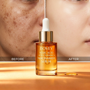 Suero Natural de Ácido Kójico y Cúrcuma con Niacinamida, Eliminador de Manchas Oscuras, Blanqueador e Iluminador, <span class=keywords><strong>Tratamiento</strong></span> Facial - Product Image 2