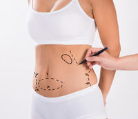 Appareil chirurgical double laser à diode triangulaire 980nm pour liposuccion, lipolyse et lifting endolaser