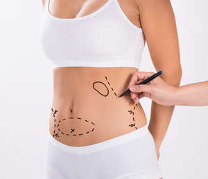 Triangel Laserdioden laser Fett absaugung für Doppel kinn 980nm Endo laser Lipolyse Fett absaugung Maschine - Product Image 5