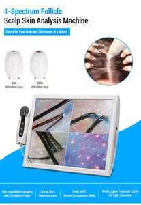 15 Inch AI HD Digital Microscope Scalp Analyzer Hair Follicle Detector Scalp Analysis Machine for Salon Spa - Product Image 6
