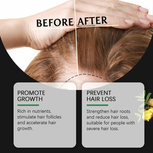 Huile essentielle pour les soins capillaires Batana, adoucit les <span class=keywords><strong>cheveux</strong></span>, nourrit et hydrate, huile hydratante pour les soins capillaires - Product Image 3