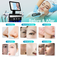 Prix d'usine, équipement de beauté à jet d'oxygène 14 en 1, équipement de beauté pour le visage, resserrement de la peau, blanchiment, nettoyage du visage, machine de spa beauté