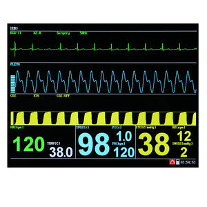 Monitor tanda Vital suhu anestesi medis dokter hewan multi parameter Monitor hewan portabel - Product Image 5