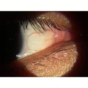 SY-S150D andere Optik-Instrumente Hands palt lampe mit Smartphone APP 6X Magni ficatioin tragbare Spaltlampe - Product Image 5