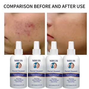 <span class=keywords><strong>Limpiador</strong></span> Facial de Ácido Hipocloroso para el Acné de Marca Privada al por Mayor, 236 ml, Elimina el Acné, Seca las Bacterias, Alivia el Enrojecimiento Después del Ejercicio para Adolescentes - Product Image 4