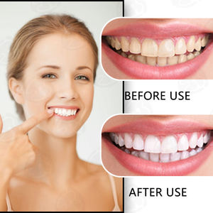 Siringa medica per laboratorio dentale 24K oro 44% perossido di carbammide 20 Hp perossido 44 Gel sbiancante per denti