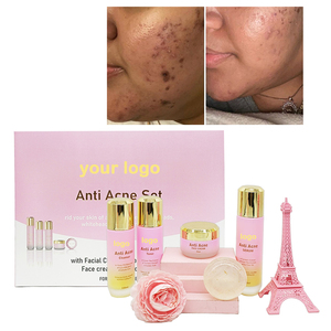 Visage corps naturel bio Anti acné ensemble de soins de la peau <span class=keywords><strong>action</strong></span> rapide supprimer les taches brunes crème blanchissante Toner ensemble de soins de la peau pour les femmes - Product Image 5