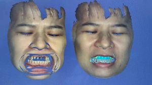 Scanner facial avec texture couleur, haute vitesse (3 millions de points par seconde) et précision de 0,04 mm pour applications dentaires numériques - Product Image 5