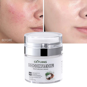 Crema de Manos con Logotipo Personalizado, con Aceite de Coco Refinado, Manteca de Cacao, Niacinamida, Colágeno, Blanqueadora, Antiarrugas, Suavizante y Sedosa - Product Image 1