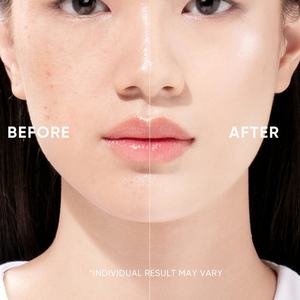 Sérum pour le soin de la peau, anti-rides, anti-âge, anti-acné, anti-taches brunes, lissage de la peau, renouvellement de la peau - Product Image 6