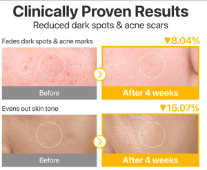 Pads Tonifiants Concentrés No5 au Glutathion et aux Vitamines, Éclaircissants et Correcteurs de Taches Brunes pour le Visage - Product Image 3