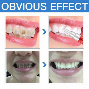 <strong>Teeth</strong> Whitening <strong>Tooth</strong> Brush <strong>Machine</strong> Oral Hygiene <strong>Cleaning</strong> Serum Removes Plaque Stains - Product Image 4