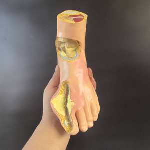 Modelo de Órgano Objetivo para la Complicación de Enfermedades por Azúcar, Modelo de Modelo Patológico de Hipertensión del Pie con Piedra del Viento y Modelo de Articulación del Pie - Product Image 2