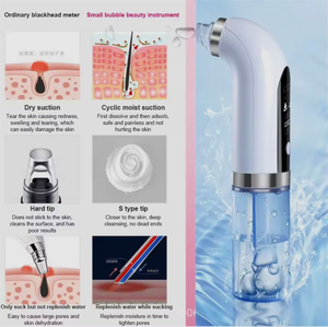 Homeuse elettrico <span class=keywords><strong>per</strong></span> rimuovere i <span class=keywords><strong>punti</strong></span> <span class=keywords><strong>neri</strong></span> strumento di bellezza <span class=keywords><strong>per</strong></span> pulire la pelle Acne brufoli e rimozione dei pori con bolla d'acqua nero - Product Image 3